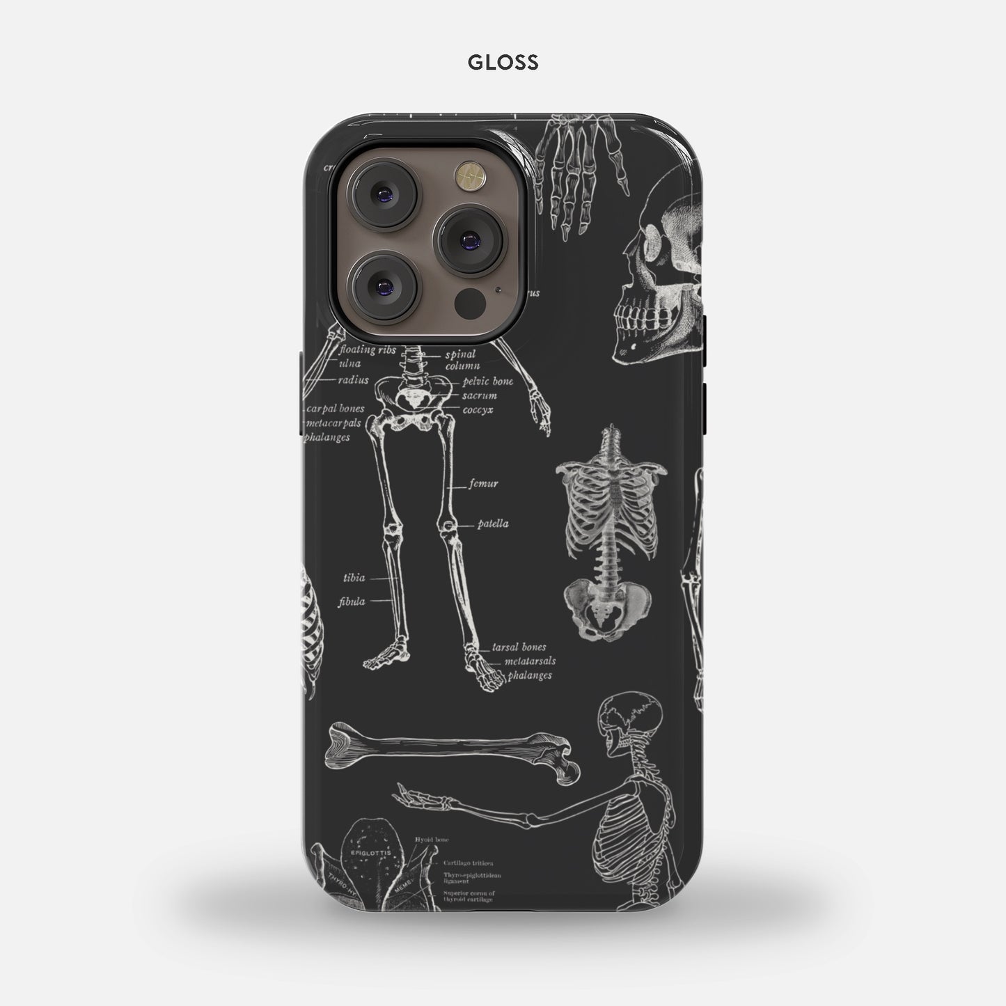 Anatomy iPhone 14 Pro Max MagSafe Tough Case